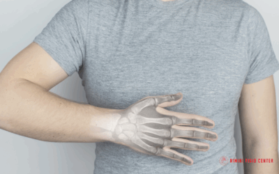 Frattura dello Scafoide: cos’è, Sintomi, Diagnosi