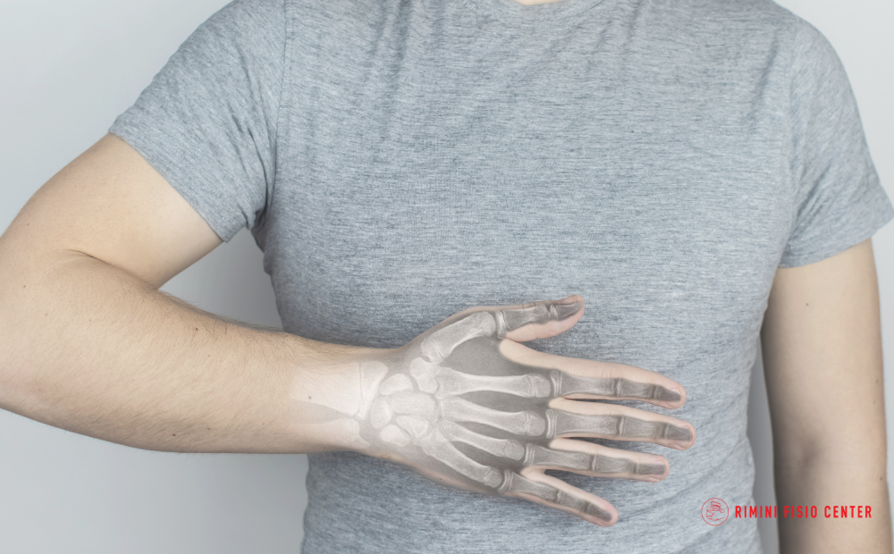 Frattura dello Scafoide: cos’è, Sintomi, Diagnosi