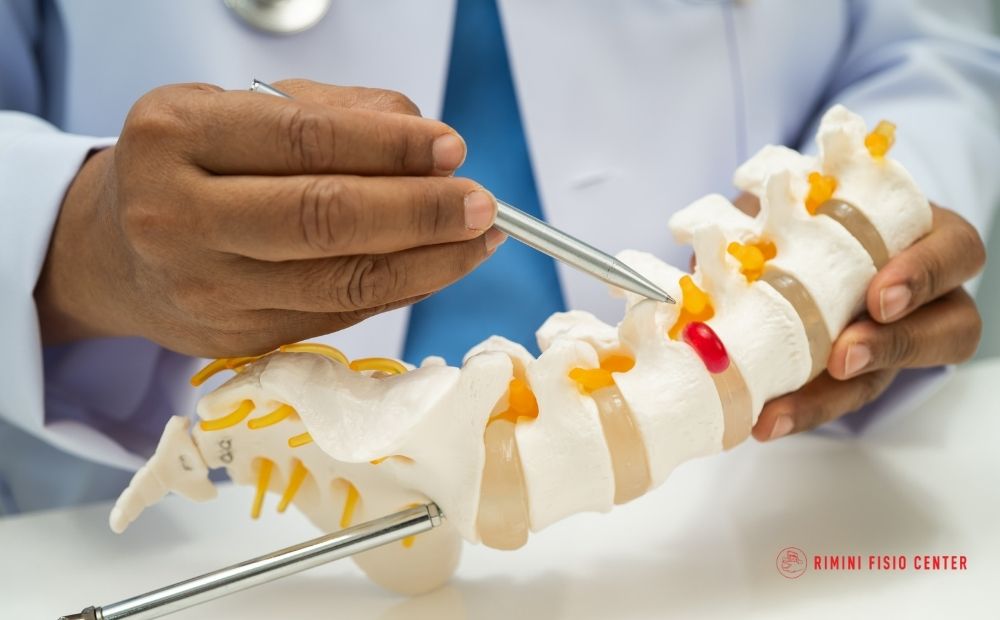 ernia del disco lombare fisioterapia