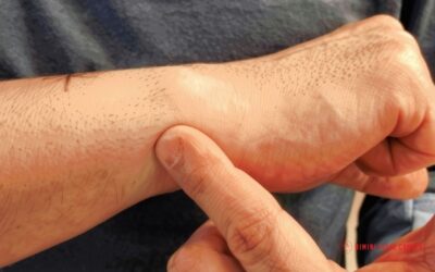 Patologie di polso e mano nel calciatore