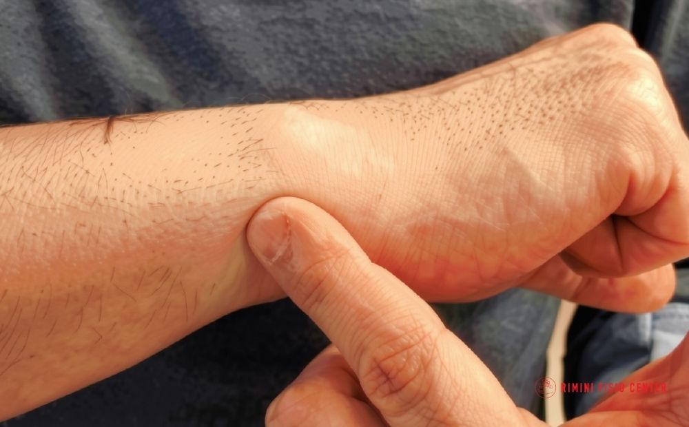 patologie polso mano calciatore